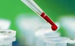 Қан тобыңыз қандай?