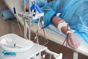 Емдік автоматты плазмафарез.